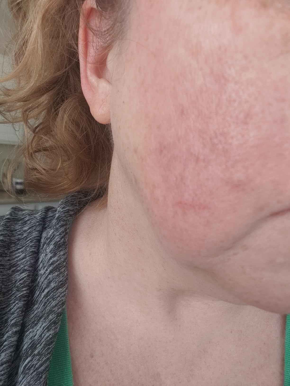 Neutrogena SkinClearing Blemish Concealer Face Makeup with Salicylic Acid Acne Medicine, Non-Comedogenic and Oil-Free Concealer Helps Cover, Treat & Prevent Breakouts, Light 10,.05 oz - Customer Photo 2