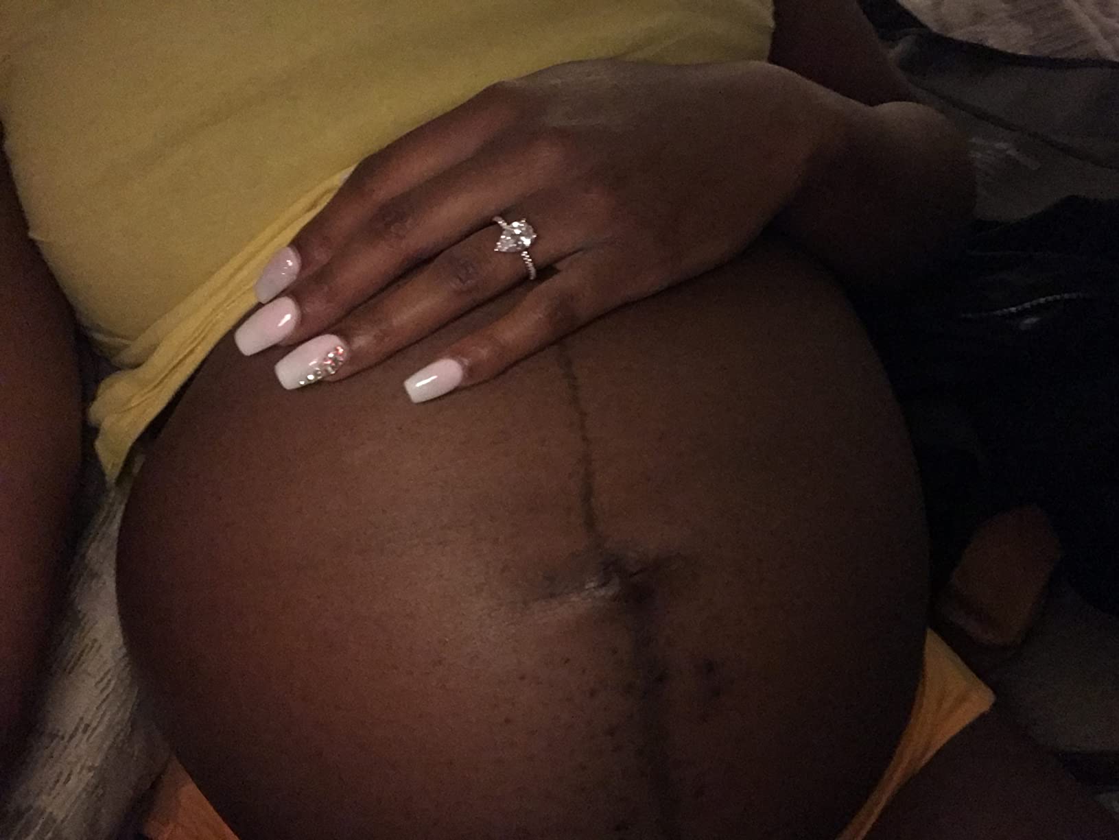 Belli Pregnancy Stretch Mark Belly Oil: 3.8 Ounces of Essential Maternity Skin Care with Vitamin E for Healthy Skin, Scar Protection, and OB-GYN, Dermatologist Recommended - Customer Photo 4