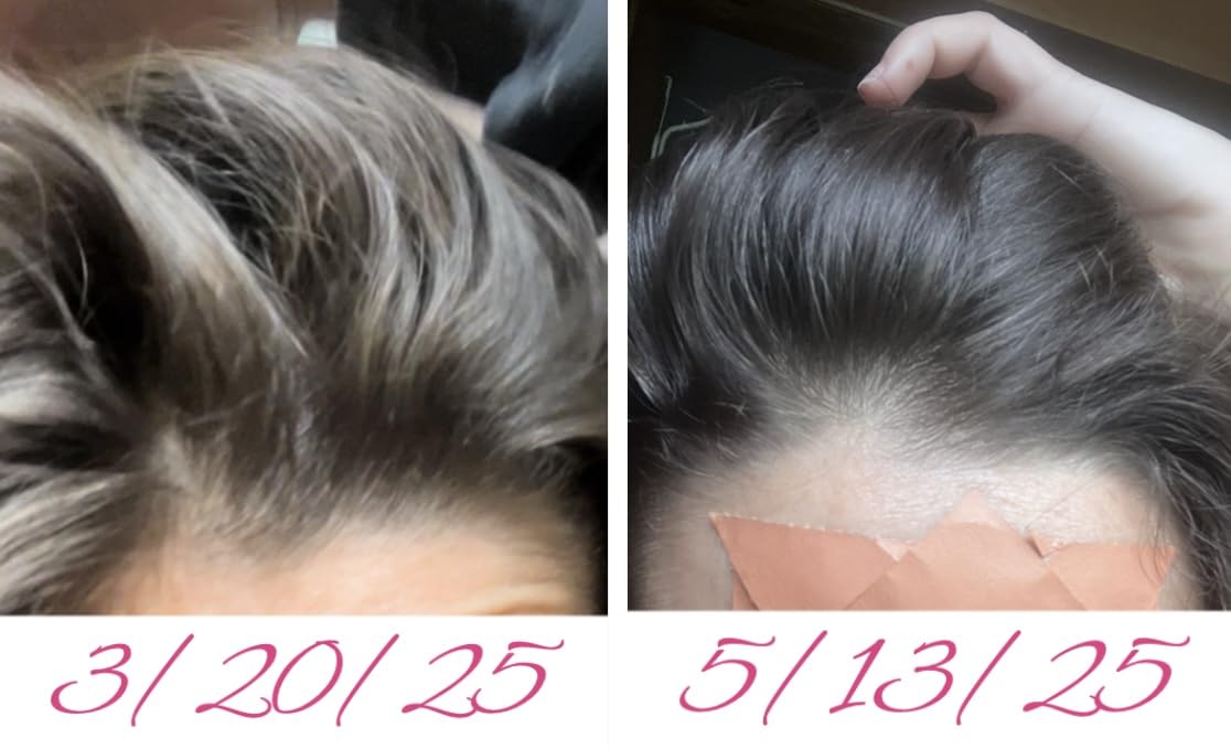 Rosemary and Biotin Shampoo for Thinning Hair - Vegan Volumizing Shampoo for Fine Hair with B Vitamins Argan Oil & Tea Tree Essential Oil - Paraben Silicone and Sulfate Free Vegan Formula (8 Fl Oz) - Customer Photo 3