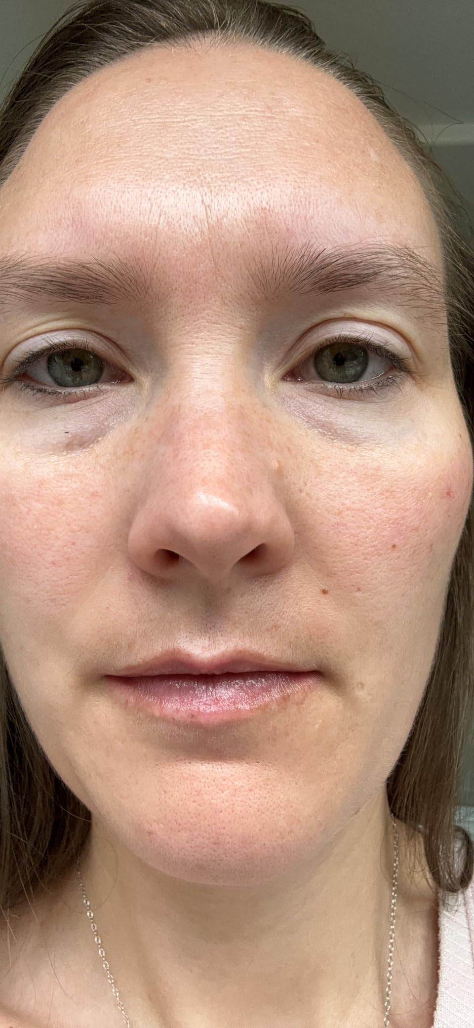 Paula's Choice CLEAR Oil-Free Moisturizer, Lightweight Face Moisturizer for Acne-Prone Skin, Pore-Minimizing Niacinamide, Soothing Antioxidants, Ceramides to Calm Redness - Customer Photo 2