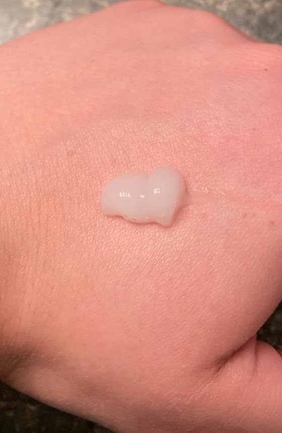 Differin Acne Treatment Gel, 30 Day Supply, Retinoid Treatment for Face with 0.1% Adapalene, Gentle Skin Care for Acne Prone Sensitive Skin, 15g Tube (Packaging May Vary) Customer Review Differin Acne Treatment Gel, 30 Day Supply, Retinoid Treatment for Face with 0.1% Adapalene, Gentle Skin Care for Acne Prone Sensitive Skin, 15g Tube (Packaging May Vary) - Customer Photo 2