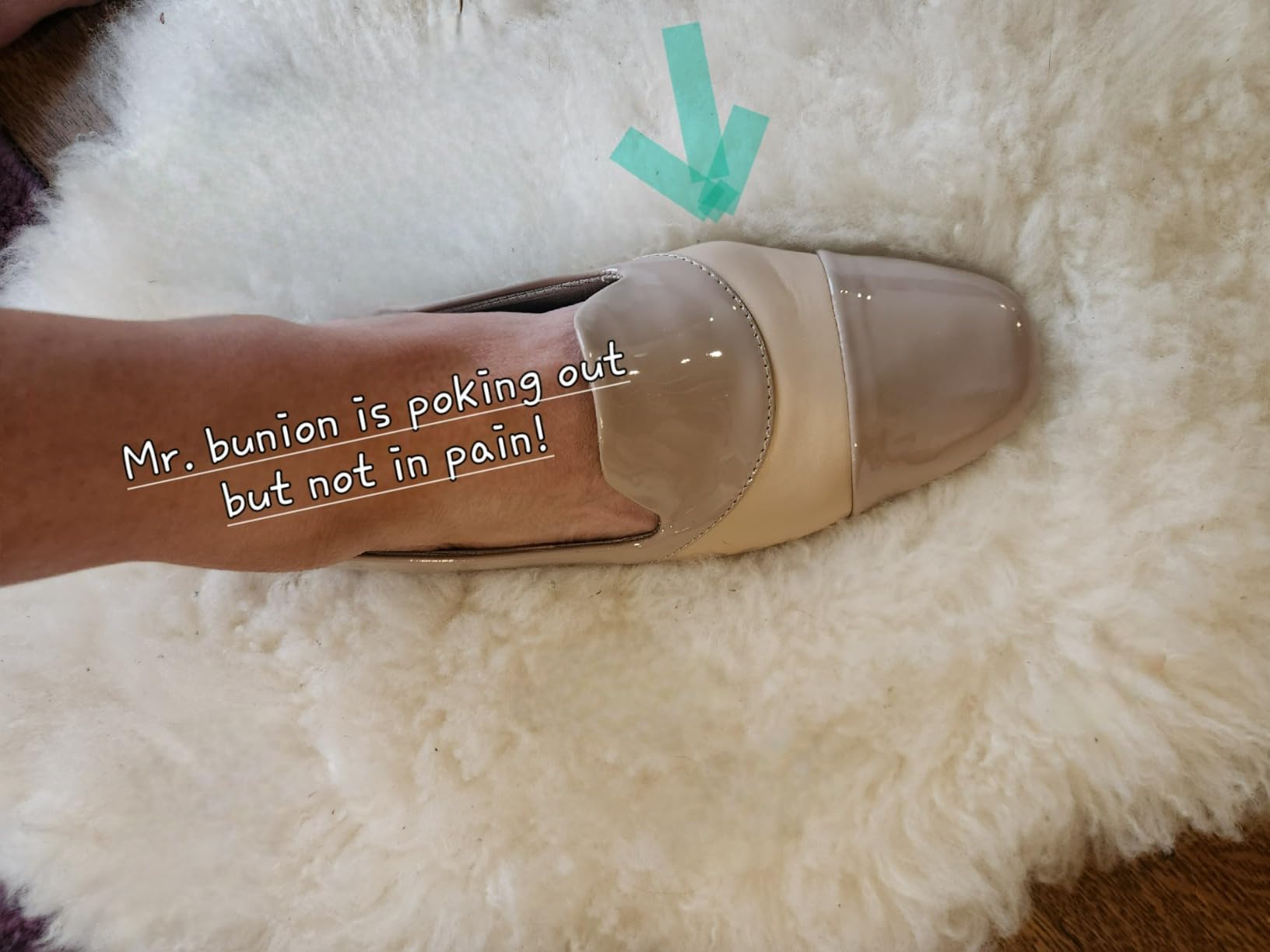 Ortho+rest Women Orthopedic Dress Shoes Bunions Loafers Slip On Orthotic Shoes Customer Review Ortho+rest Women Orthopedic Dress Shoes Bunions Loafers Slip On Orthotic Shoes - Customer Photo 3