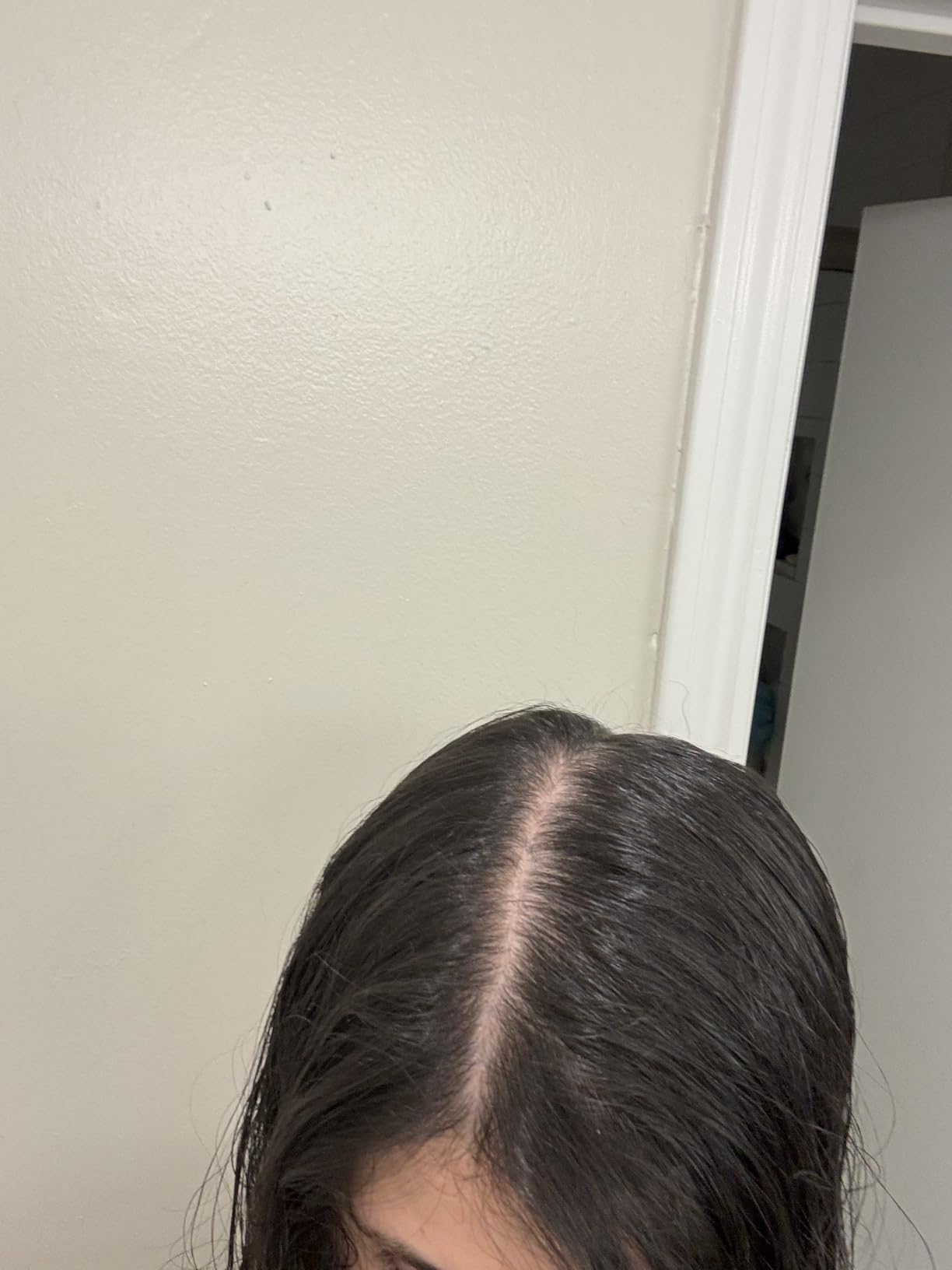 OUAI Anti Dandruff Shampoo - Soothing Salicylic Acid Shampoo for Flaky, Dry and Itchy Scalp - Reduces Itching, Redness and Irritation - Sulfate Free Scalp Care (10 Fl Oz) - Customer Photo 2