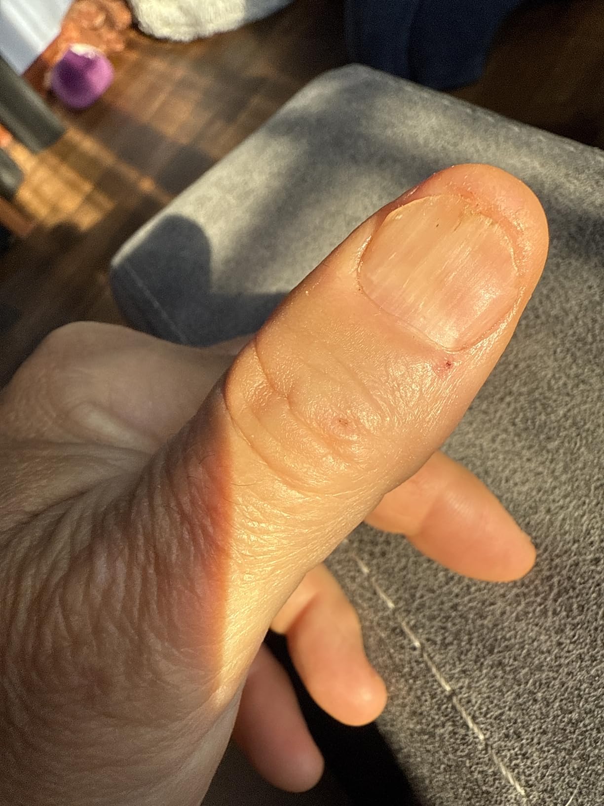 CND SolarOil Cuticle Oil, Blend Of Jojoba, Vitamin E, Rice Bran & Sweet Almond Oils, Moisturizes & Conditions - Customer Photo 3