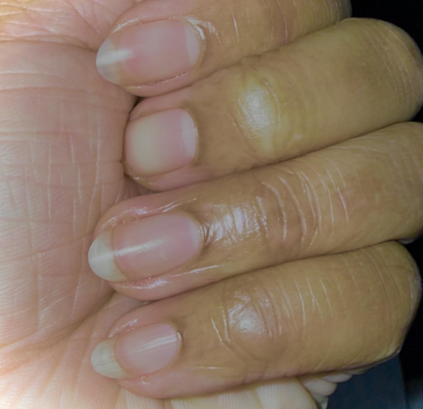CND SolarOil Cuticle Oil, Natural Blend Of Jojoba, Vitamin E, Rice Bran and Sweet Almond Oils, Moisturizes and Conditions Skin customer photo 2