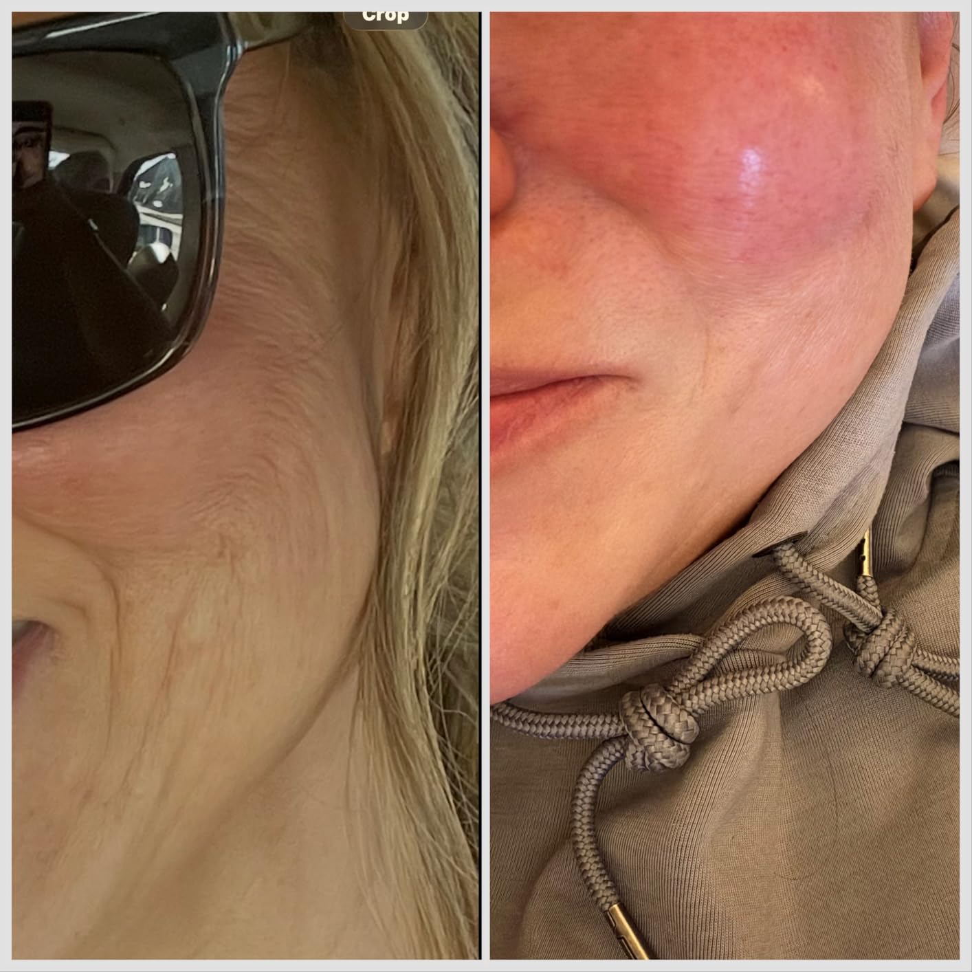 RoC Retinol Correxion Deep Wrinkle Retinol Face Serum with Ascorbic Acid, Anti-Aging Treatment for Fine Lines, Dark Spots, Post Acne Scars, 1 Oz (Packaging May Vary) customer photo 2
