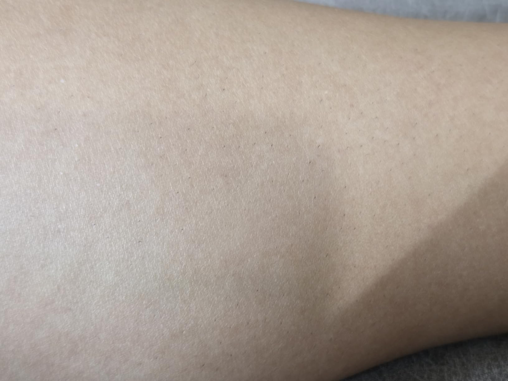 Braun IPL, Silk Expert Pro 5, IPL Hair Removal for Women and Men, Permanent Laser Hair Reduction At-Home, 2 Heads, Pouch, IPL5137 customer photo 1