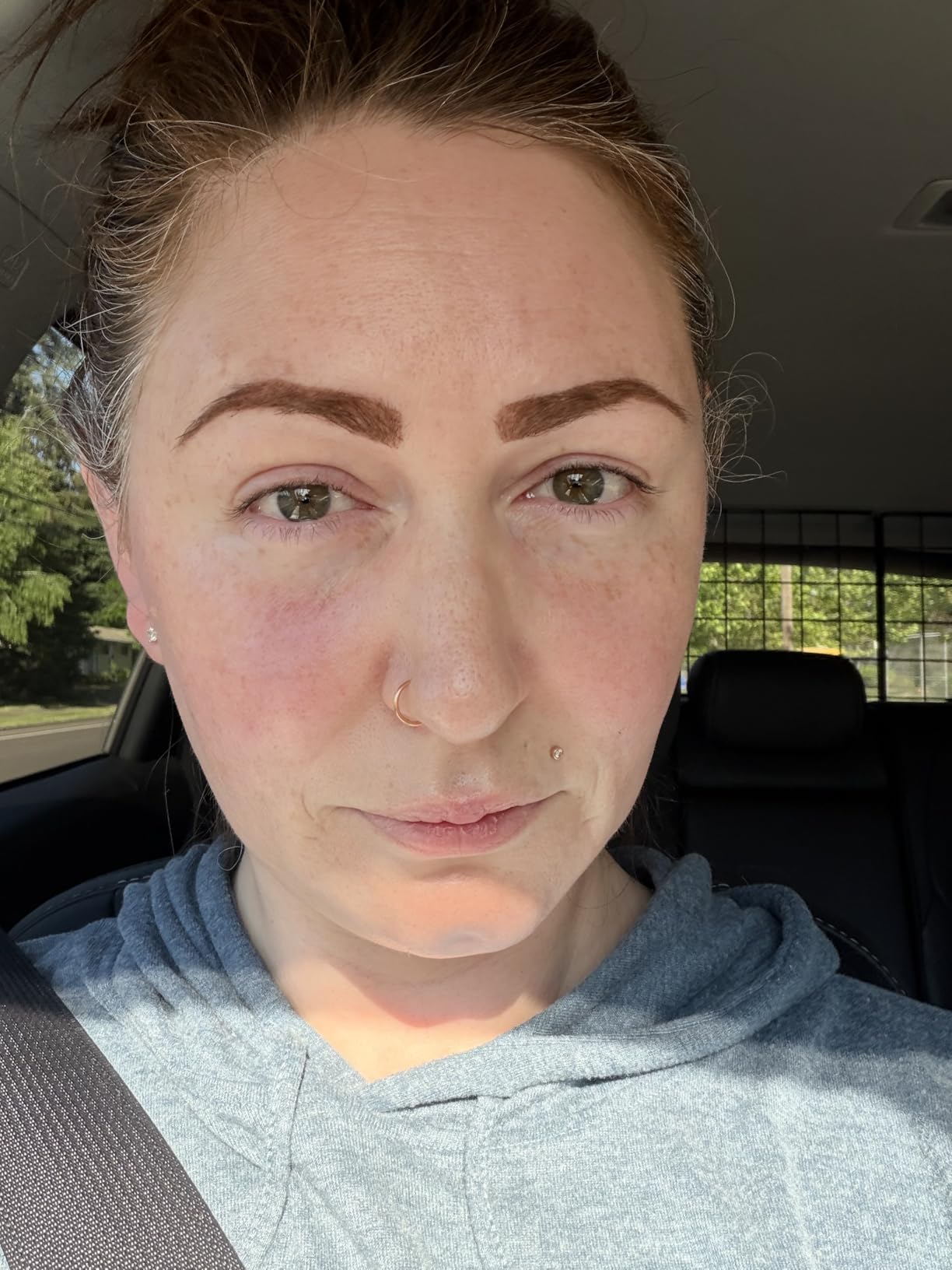 The Ordinary The Daily Set, Daily Skincare Routine with Squalane Cleanser, Hyaluronic Acid 2% + B5, and Natural Moisturizing Factors + HA customer photo 1