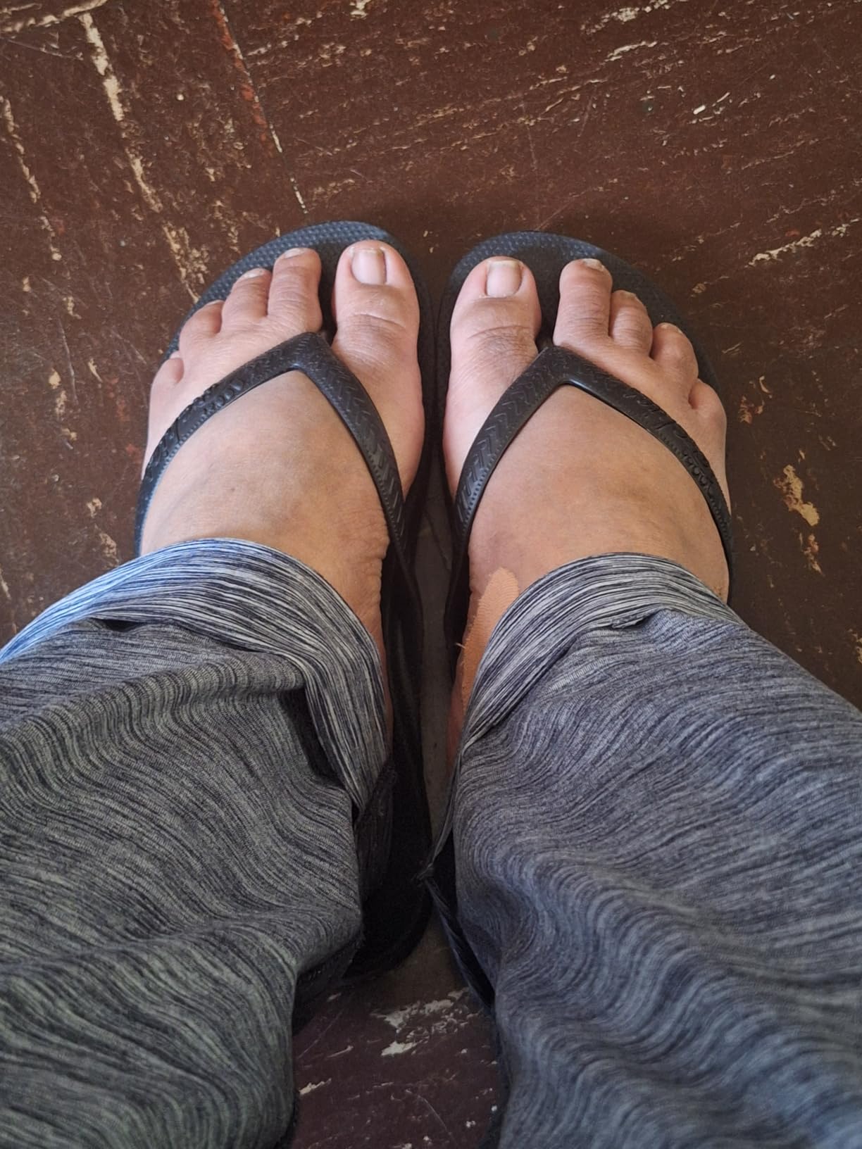 Arch Support Flip Flops for Men & Women - Orthotic Sandals for Plantar Fasciitis Relief customer photo 2