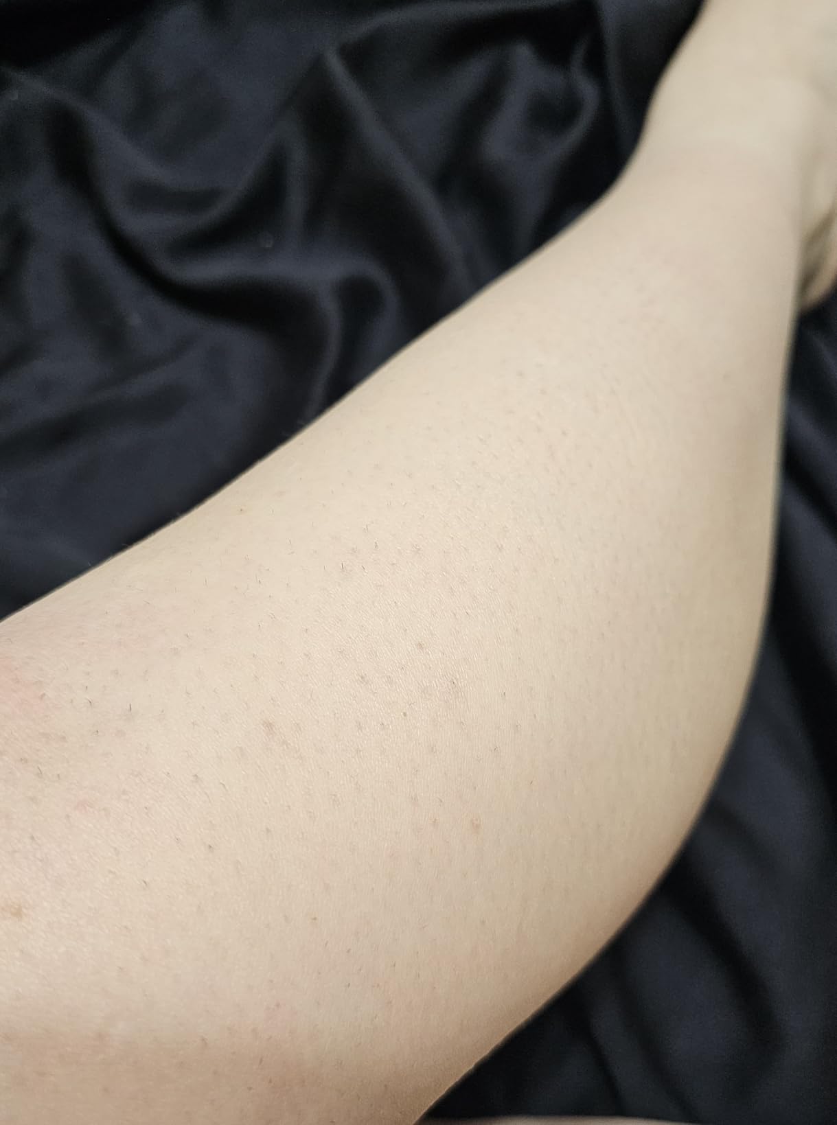 Philips Lumea 8000 Series IPL Hair Removal Device, Permanent Laser Hair Reduction for Women & Men, Easy and Comfortable Use at Home, SenseIQ, 3 Attachments for Body, Face, Intimate, BRI937/03 customer photo 2