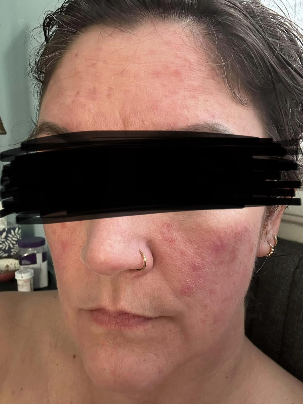 Paula's Choice BOOST 10% Azelaic Acid Booster Cream Gel, 1 Fl Oz | Oil-Free Serum Fades Discoloration & Post-Blemish Marks with Licorice Extract & Salicylic Acid, Fragrance-Free customer photo 1