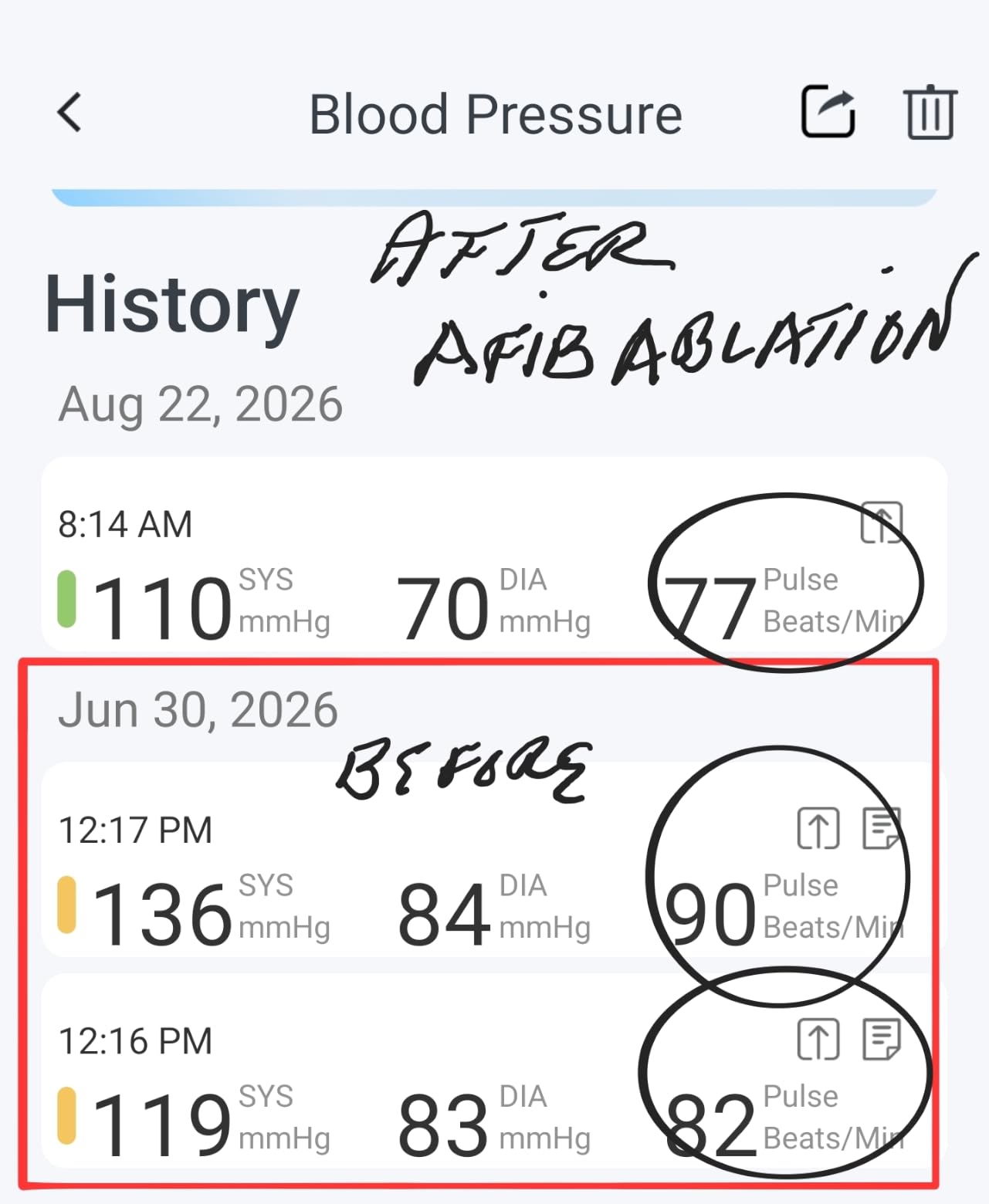 iHealth Track Smart Upper Arm Blood Pressure Monitor with Wide-Range Cuff | Bluetooth BP monitor for standard to large adult arms, compatible with iOS and Android customer photo 2