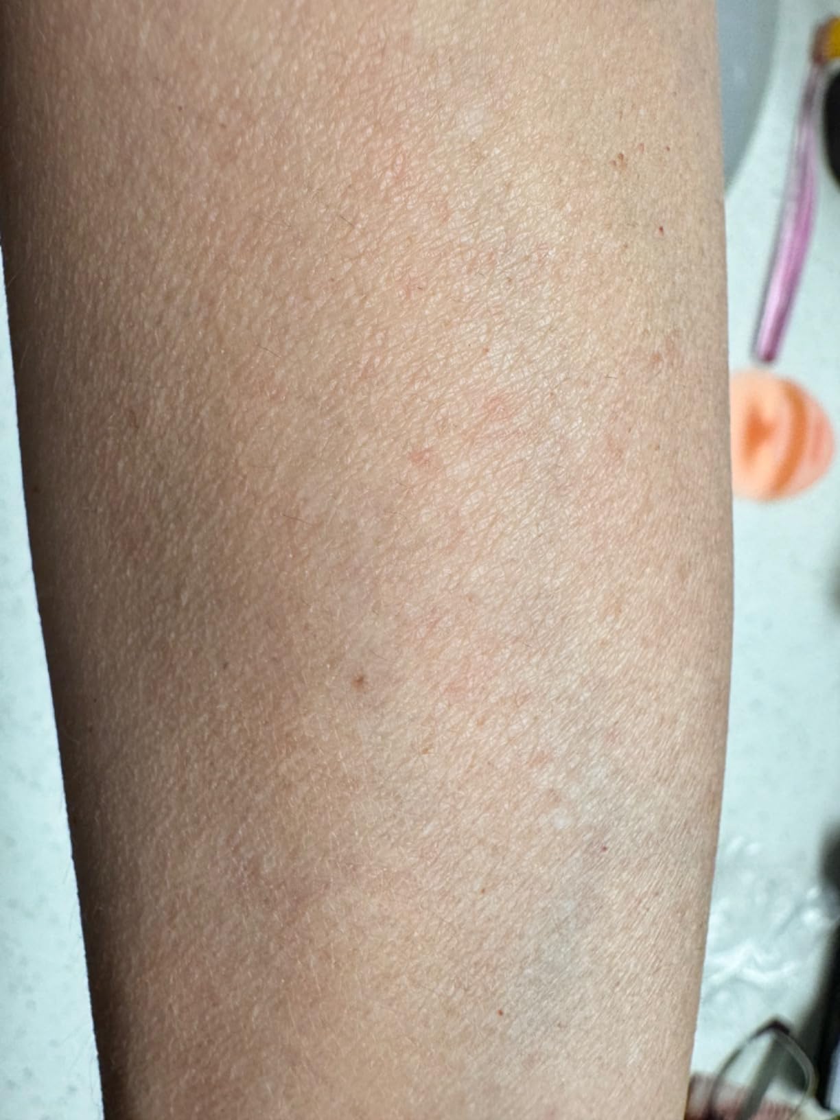 Braun Silk-épil 3 3-270, Epilator for Women for Long-Lasting Hair Removal, 20 Tweezer System, Smartlight Technology, Massage Rollers, Shaver and Trimmer Head Included customer photo 2