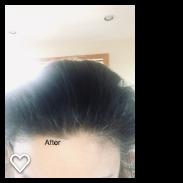 Garnier Invisible Dry Shampoo with no Visible Residue powered by Rice Starch to Instantly Absorb Oil, Refresh and Volumize, Silicone Free, Mint Mojito by Fructis, 4.4 oz. customer photo 1