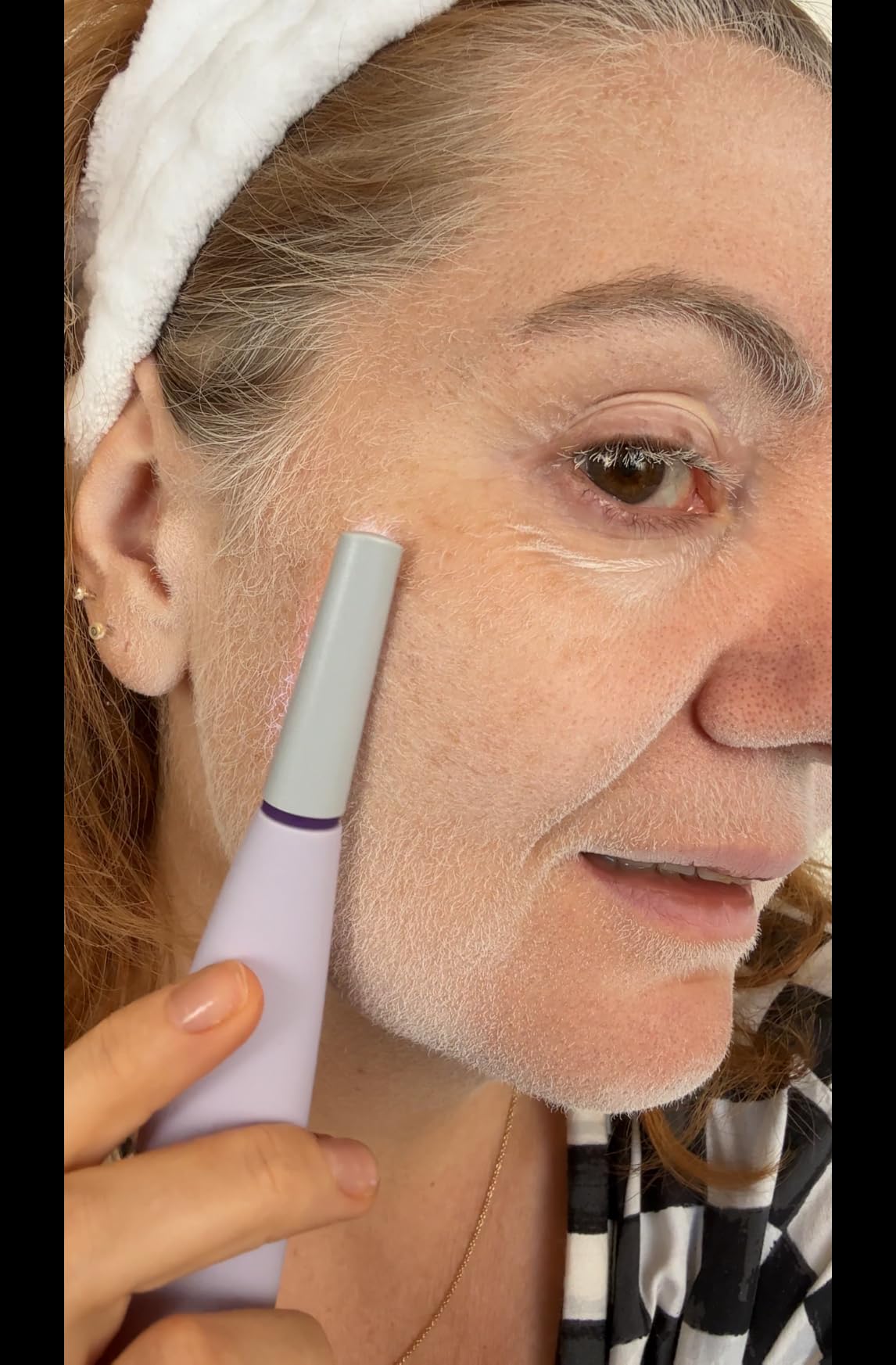 Michael Todd Beauty Sonicsmooth Dermaplane Razor for Women Face | Dermaplaning System + Eyebrow Trimmer, Peach Fuzz Remover, 8 Weeks of Dermaplaning Blades, 3-Year Warranty customer photo 2