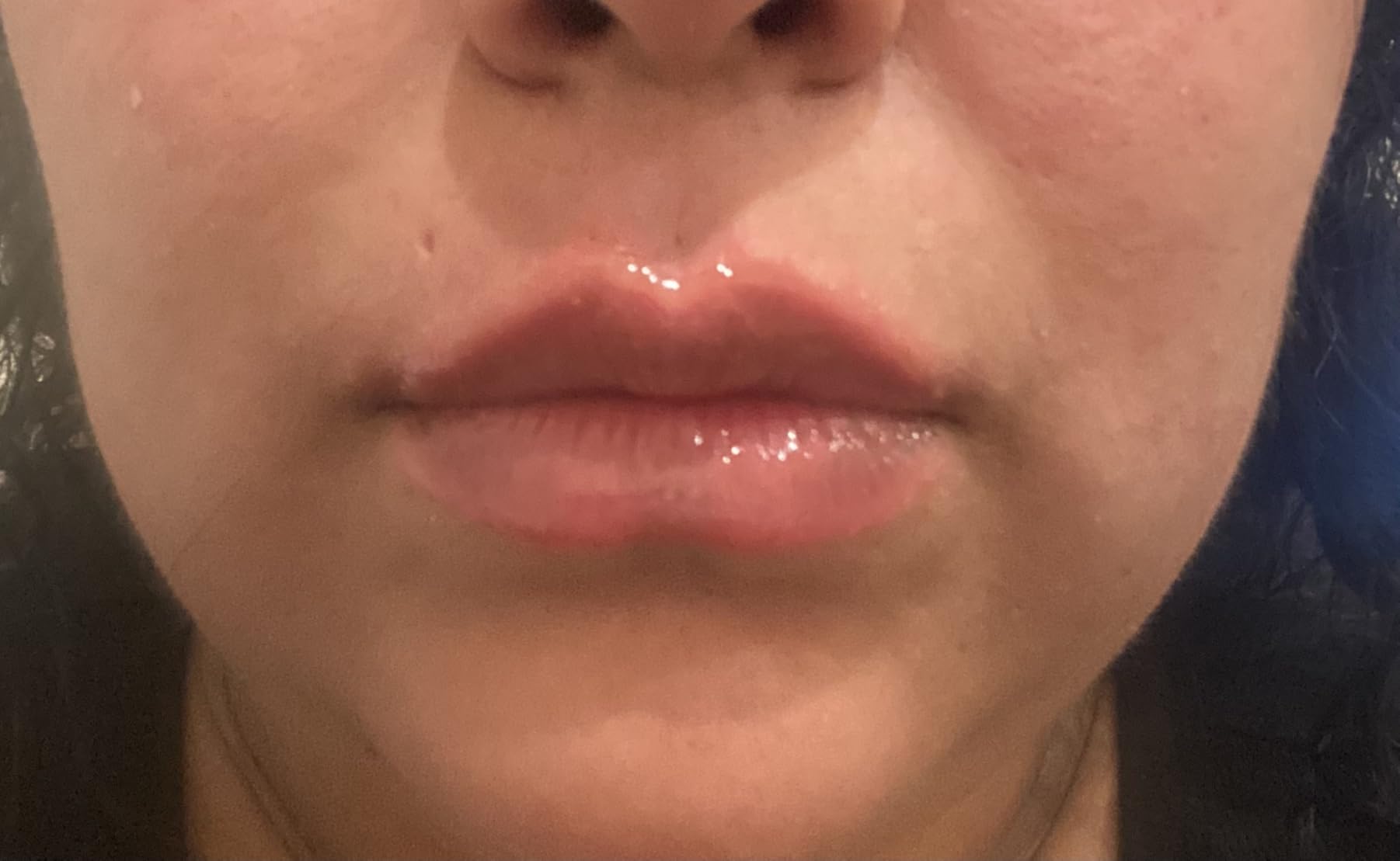 RoC Derm Correxion Lip Volumizer, Hyaluronic Acid Lip Plumper Serum 0.34oz, Hyaluronic acid peptide treatment, Vitamin E lip gloss with metal applicator customer photo 1