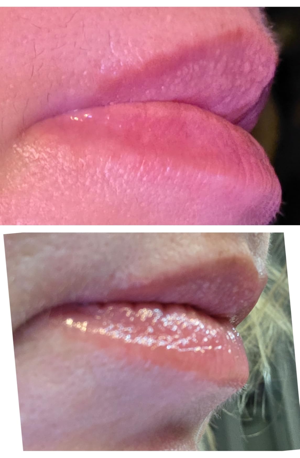 RoC Derm Correxion Lip Volumizer, Hyaluronic Acid Lip Plumper Serum 0.34oz, Hyaluronic acid peptide treatment, Vitamin E lip gloss with metal applicator customer photo 2