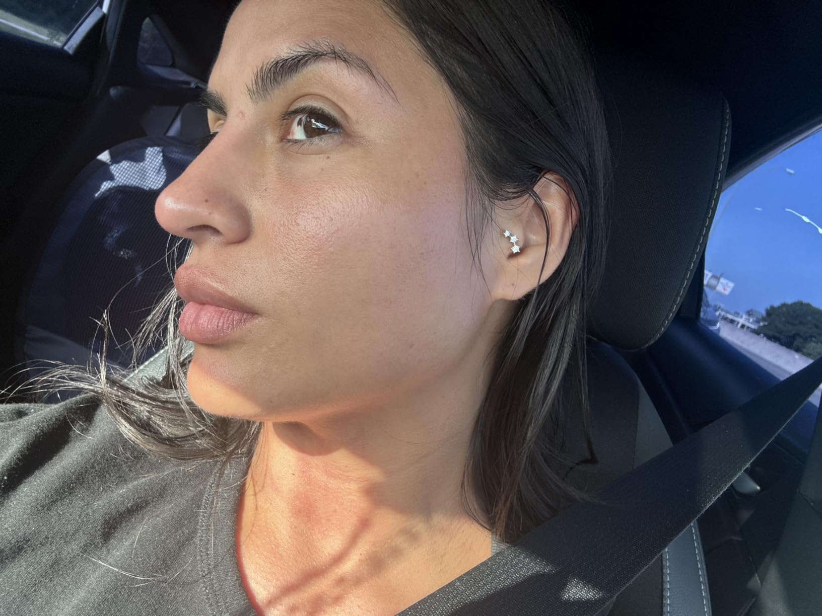 Good Molecules 10% Azelaic Acid Treatment for Face - Blurs Facial Redness & Evens Skin Tone - Brightens the Look of Dark Spots & Refines Texture - Vegan & Fragrance-Free Skincare (30ml / 1.01 fl oz.) customer photo 1